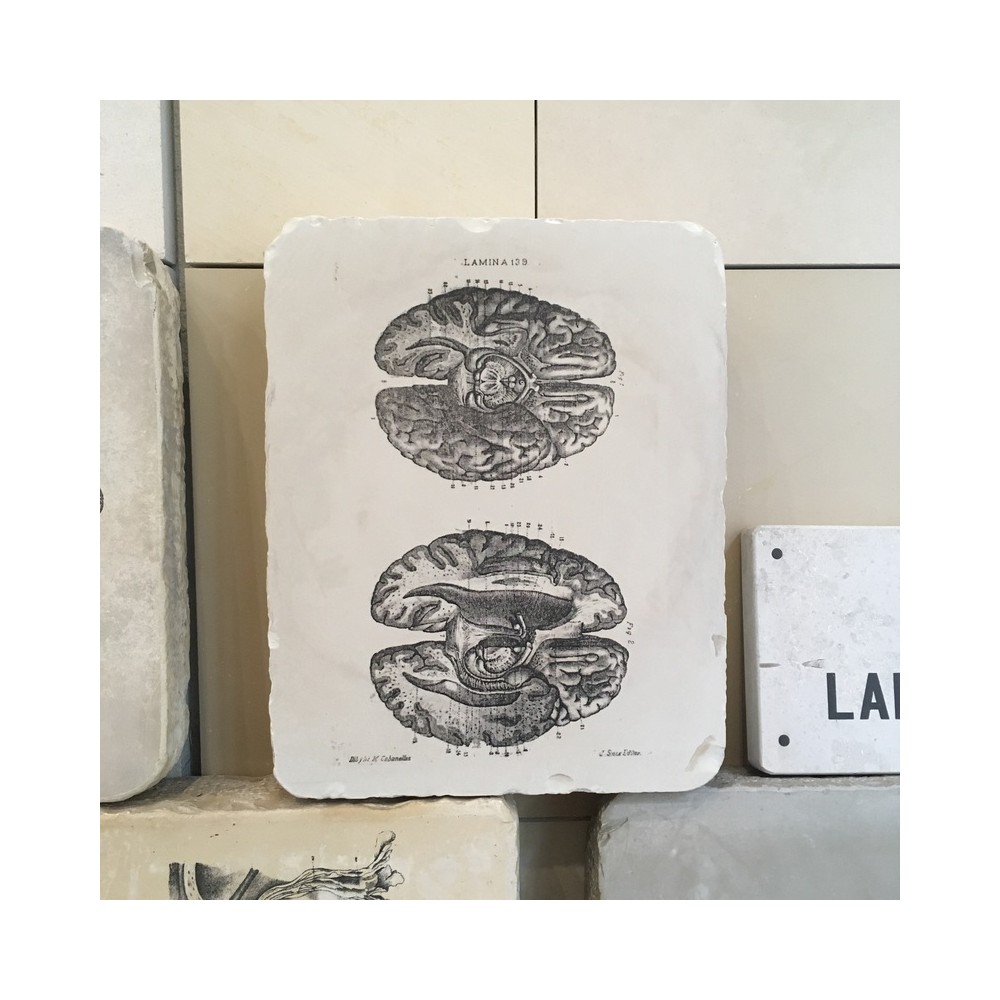 piedra litografica anatomia cerebros