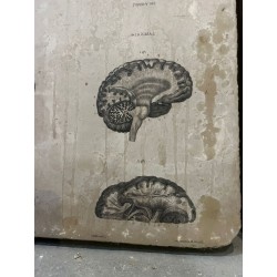 Piedra litográfica edicion anatomia descriptiva cerebros. Lamina 141