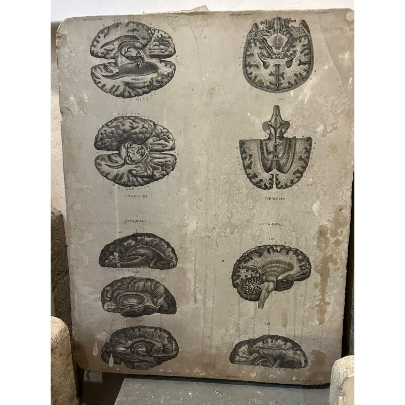 Piedra litográfica edicion anatomia descriptiva cerebros 4 laminas