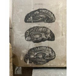 Piedra litográfica edicion anatomia descriptiva cerebros. Lamina 142