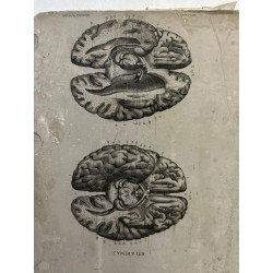 Piedra litográfica edicion anatomia descriptiva cerebros. Lamina 139