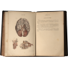 Piedra litográfica Solnhofen ORIGINAL Anatomia cerebros 49x38x7cm